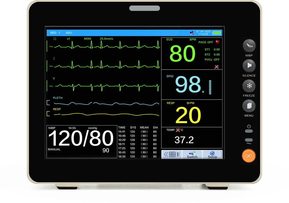 8-Inch Touchscreen+EtCO2 Portable Patient Monitor- Tracks Vital Parameters  Including ECG, RESP, NIBP, Oxygen Saturation, Pulse Rate, Temperature and  Etco2. – Wellue
